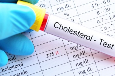 Фото: Холестериновые накопления. Как расшифровать анализы и снизить риски сердечно-сосудистых заболеваний