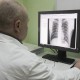 Фото: 85% больных туберкулезом в Беларуси выздоравливают - директор РНПЦ пульмонологии и фтизиатрии