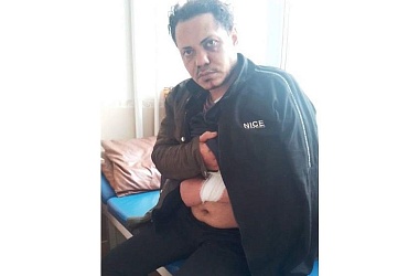 Фото: «Демократия» во всей красе. Еще один беженец пострадал от польской миграционной политики