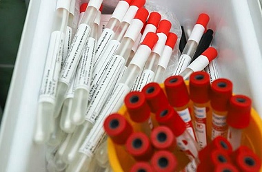 Фото: Заболеваемость COVID-19 в мире выросла за месяц более чем на 50%